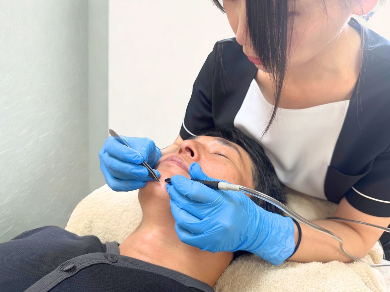 スーパーフラッシュ脱毛