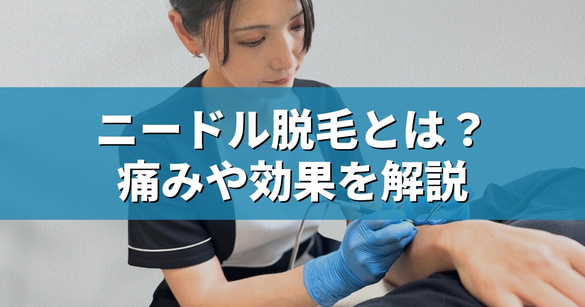 ニードル脱毛とは？痛みや効果を解説